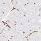 Immunohistochemical staining of human cerebral cortex shows strong membranous positivity in endothelial cells.