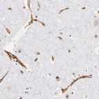 Anti-LAMC1 Antibody