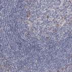Immunohistochemical staining of human tonsil shows no membranous positivity in non-germinal center cells as expected.