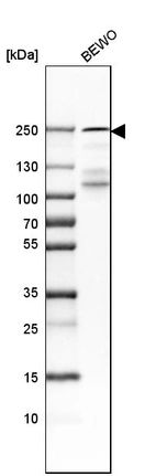 Western blot analysis in human cell line BEWO.
