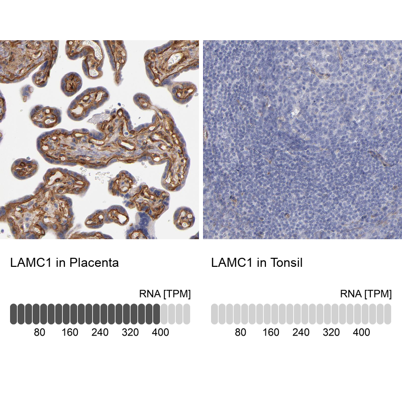 Anti-LAMC1 Antibody