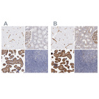 Immunohistochemical staining of human cerebral cortex, kidney, placenta and tonsil using Anti-LAMC1 antibody HPA001909 (A) shows similar protein distribution across tissues to independent antibody HPA001908 (B).
