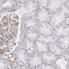 Immunohistochemical staining of human kidney shows strong membranous positivity in cells in glomeruli.
