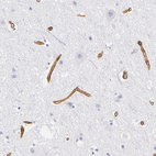 Immunohistochemical staining of human cerebral cortex shows strong membranous positivity in endothelial cells.