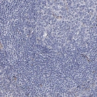 Immunohistochemical staining of human tonsil shows no membranous positivity in non-germinal center cells as expected.