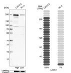 Western blot analysis in human cell line CACO-2 and human cell line PC-3.