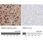 Anti-FARSA Antibody