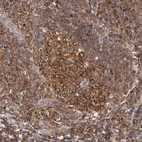 Immunohistochemical staining of human tonsil shows strong cytoplasmic positivity in germinal center cells.