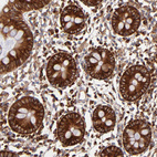 Anti-FARSA Antibody