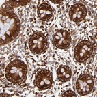 Immunohistochemical staining of human colon shows strong cytoplasmic positivity in glandular cells.