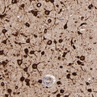 Immunohistochemical staining of human cerebral cortex shows very strong cytoplasmic positivity in neurons.