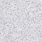 Immunohistochemical staining of human liver shows no cytoplasmic positivity in hepatocytes as expected.