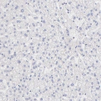 Immunohistochemical staining of human liver shows no cytoplasmic positivity in hepatocytes as expected.