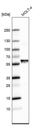 Anti-FARSA Antibody