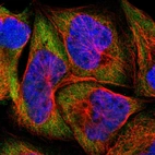 Immunofluorescent staining of human cell line A-431 shows localization to cytosol.