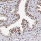 Anti-TFAP4 Antibody