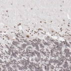 Immunohistochemical staining of human cerebellum shows moderate nuclear positivity in Purkinje cells.