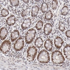 Immunohistochemical staining of human duodenum shows moderate nuclear positivity in glandular cells.