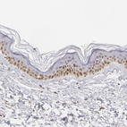 Immunohistochemical staining of human skin shows weak nuclear positivity in squamous epithelial cells.