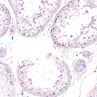 Immunohistochemical staining of human testis shows moderate nuclear positivity in cells in seminiferous ducts.
