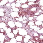 Immunohistochemical staining of human bone marrow shows moderate to strong nuclear positivity in hematopoietic cells.