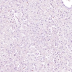 Immunohistochemical staining of human liver shows no nuclear positivity in hepatocytes as expected.