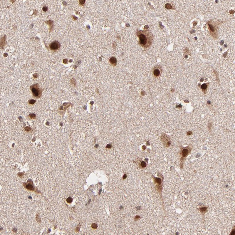 Anti-TOP1MT Antibody