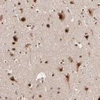 Anti-TOP1MT Antibody