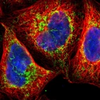 Immunofluorescent staining of human cell line A-431 shows localization to mitochondria.