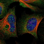 Anti-TSC22D3 Antibody
