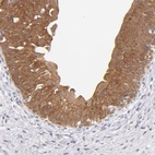 Immunohistochemical staining of human urinary bladder shows high expression.