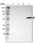 Lane 1: Marker [kDa] 219, 112, 85, 49, 32, 25, 18_br/_Lane 2: Human cell line RT-4_br/_Lane 3: Human cell line U-251MG sp_br/_Lane 4: Human cell line A-431_br/_Lane 5: Human liver tissue
