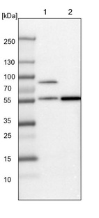 Lane 1: Mouse liver tissue lysate_br/_Lane 2: Rat liver tissue lysate