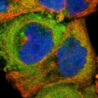 Immunofluorescent staining of human cell line A-431 shows localization to cytosol.