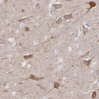 Immunohistochemical staining of human hippocampus shows cytoplasmic positivity in neuronal cells.