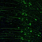 Immunofluorescence staining of mouse cingulate cortex shows strong cytoplasmic positivity in neuronal cell bodies and proximal dendrites.