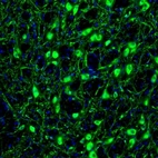 Immunofluorescence staining of mouse globus pallidus shows strong cytoplasmic immunoreactivity in neurons.