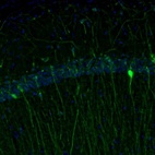 Immunofluorescence staining of mouse hippocampus shows cytoplasmic positivity in a subset of interneurons in the CA1 area.