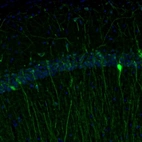 Immunofluorescence staining of mouse hippocampus shows cytoplasmic positivity in a subset of interneurons in the CA1 area.