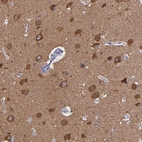 Immunohistochemical staining of human cerebral cortex shows cytoplasmic immunoreactivity in neuronal cell bodies.