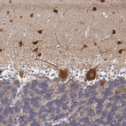 Immunohistochemical staining of human cerebellum shows strong cytoplasmic immunoreactivity in Purkinje cells and neurons in the molecular layer.