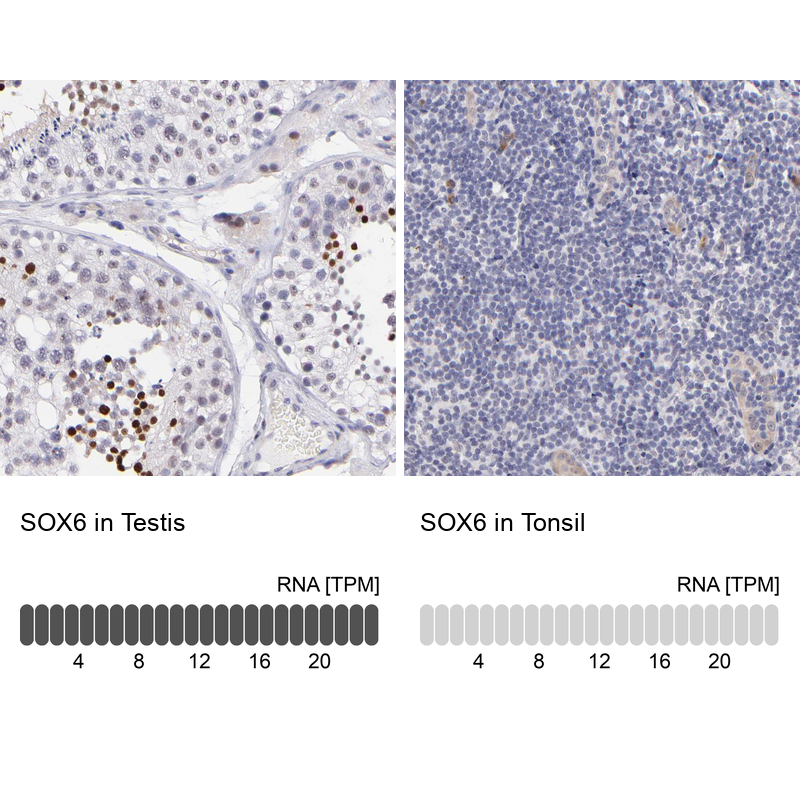 Anti-SOX6 Antibody