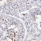 Immunohistochemical staining of human testis shows moderate to strong nuclear positivity in cells in seminiferous ducts.