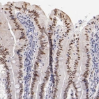 Immunohistochemical staining of human small intestine shows moderate nuclear positivity in glandular cells.