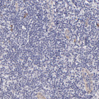 Anti-SOX6 Antibody