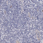 Immunohistochemical staining of human tonsil shows no positivity in lymphoid cells as expected.
