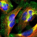 Immunofluorescent staining of human cell line U-2 OS shows localization to plasma membrane & cytosol.