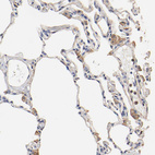 Anti-TAGLN2 Antibody