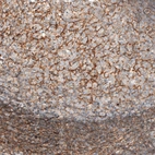 Immunohistochemical staining of human tonsil shows moderate to strong positivity in germinal center cells.