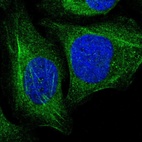 Immunofluorescent staining of human cell line U-2 OS shows localization to cytosol & actin filaments.